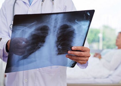 What is Ventilator-associated Pneumonia?
